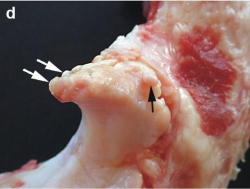 Curas naturales para el cuello espolones óseos