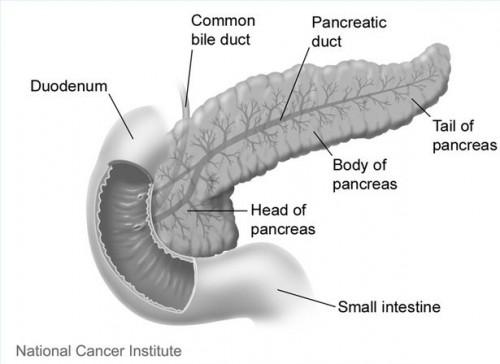 Etapas finales de cáncer de páncreas